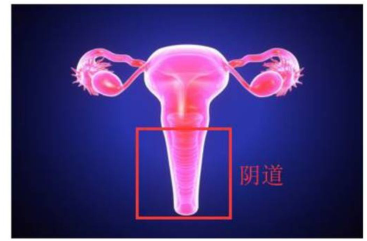 1567481084445309.png 盆底康復(fù)治療