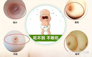 1572579096672261.png 產(chǎn)后康復(fù)治療