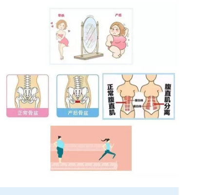 1578462545452290.png 產(chǎn)后恢復(fù)