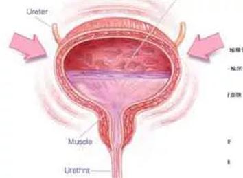 1589610816436840.jpg 6fa7a393c93153eb82590531eee9c58.jpg