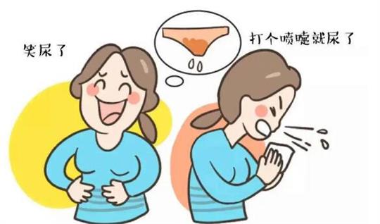 盆底康復(fù)治療儀 盆底康復(fù)治療儀