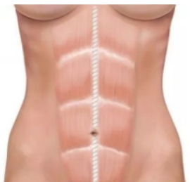 1602553324641153.png 產(chǎn)后修復(fù)