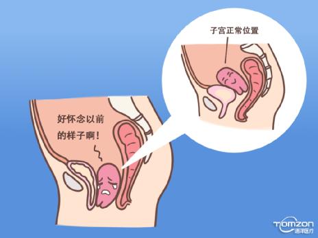 產(chǎn)后康復(fù)治療儀 產(chǎn)后康復(fù)治療儀